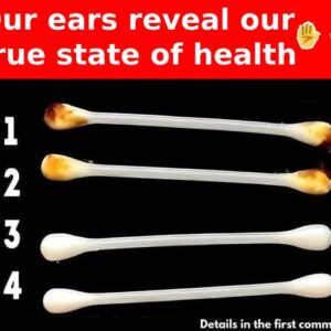 Our ears reveal our true state of health