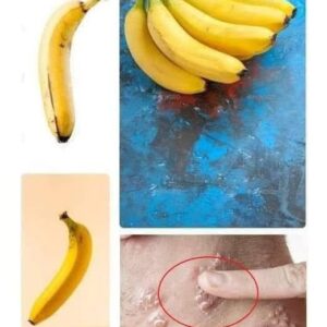 Did you know that it you eat BANANA EVERY DAY your body can…