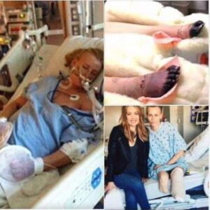 Her Legs Are Amputated After Using a Common Household Product – Now She’s Warning Women Everywhere!