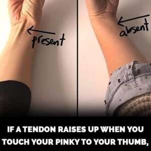 How to check if you’ve lost this tendon on your arm to evolution