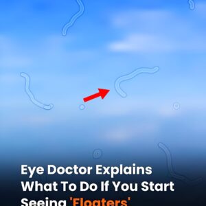 What Are Eye Floaters? Here What To Do If you Start Seeing Them