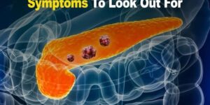 10 Warning Signs of Pancreatic Cancer You Must Not Overlook10 Warning Signs of Pancreatic Cancer You Must Not Overlook