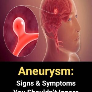 Aneurysm: Symptoms You Shouldn’t Ignore