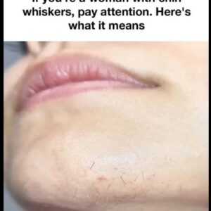The Science Behind Chin Hair Growth