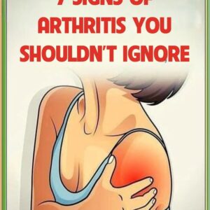 7 Signs of Arthritis You Shouldn’t Ignore
