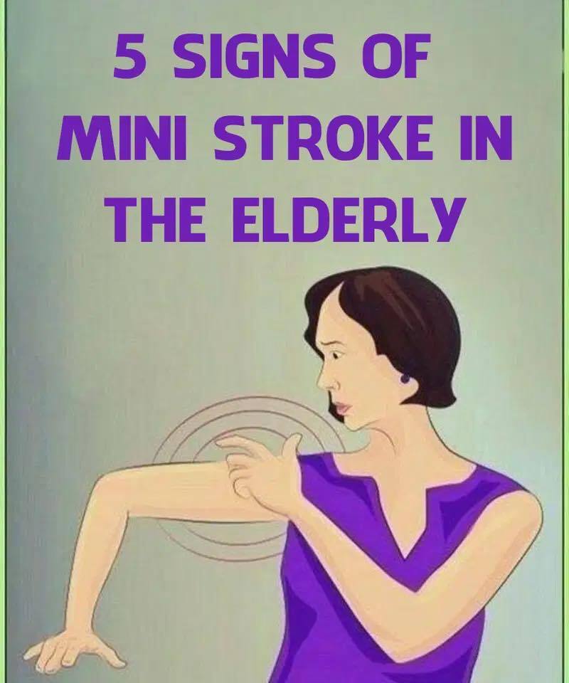 Is It Just Aging — or a Warning Sign of a Mini-Stroke?